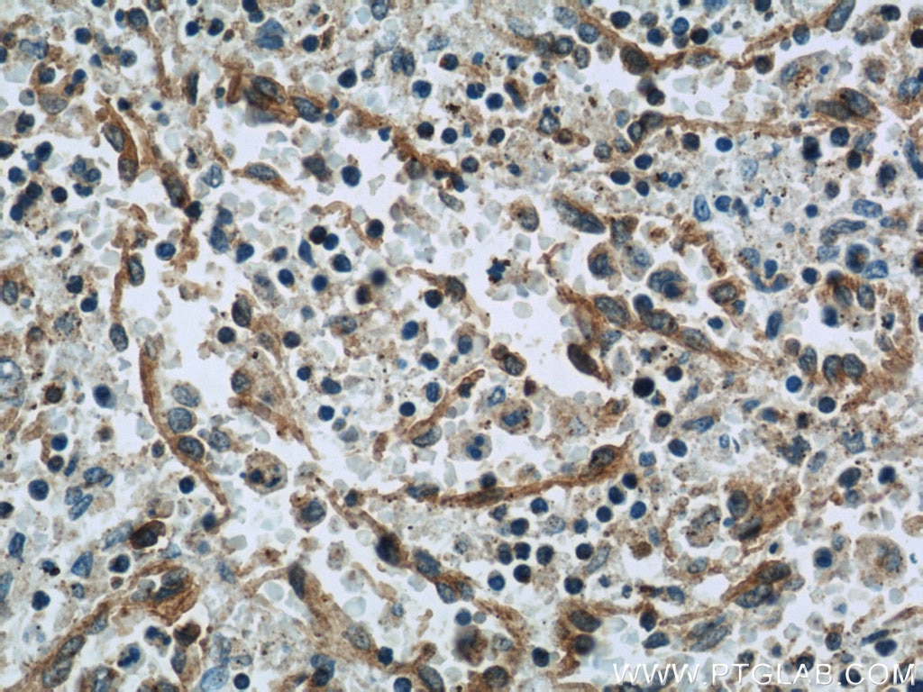 Immunohistochemistry (IHC) staining of human spleen tissue using HLA-F Polyclonal antibody (14670-1-AP)