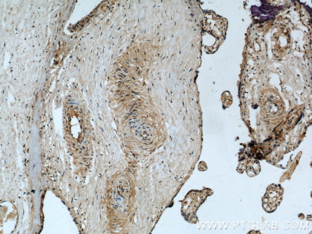 Immunohistochemistry (IHC) staining of human placenta tissue using HLA-F Polyclonal antibody (14670-1-AP)