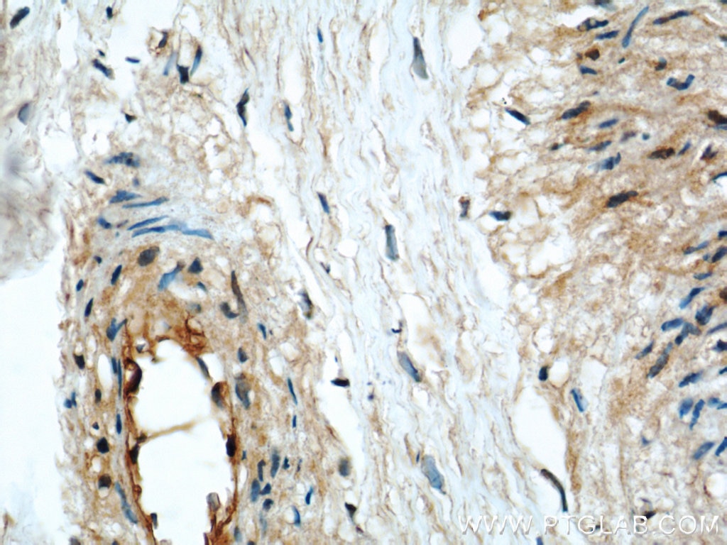 Immunohistochemistry (IHC) staining of human placenta tissue using HLA-F Polyclonal antibody (14670-1-AP)