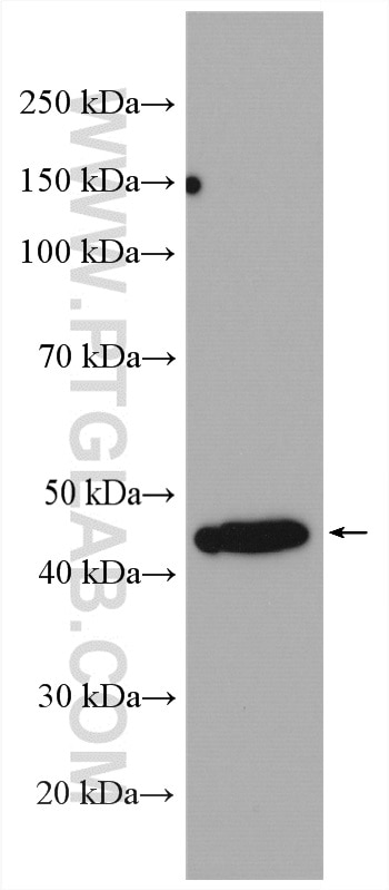 Western Blot (WB) analysis of A431 cells using HLA-F Polyclonal antibody (14670-1-AP)