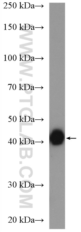 Western Blot (WB) analysis of Raji cells using HLA-F Polyclonal antibody (14670-1-AP)