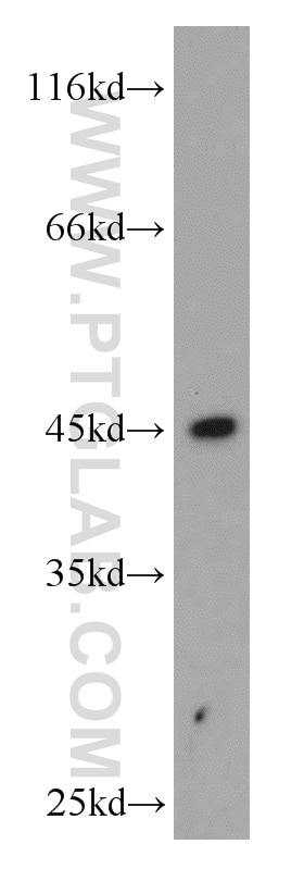 WB analysis of human placenta using 14670-1-AP