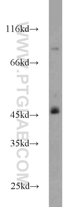 Western Blot (WB) analysis of Raji cells using HLA-F Polyclonal antibody (14670-1-AP)