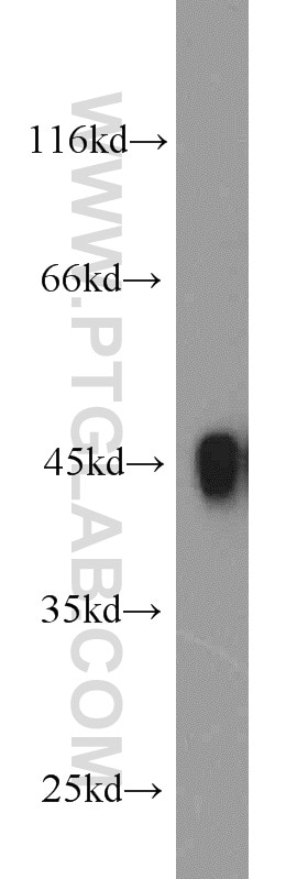 Western Blot (WB) analysis of human spleen tissue using HLA-F Polyclonal antibody (14670-1-AP)