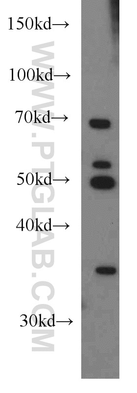 Western Blot (WB) analysis of Jurkat cells using HLA-F Polyclonal antibody (55379-1-AP)
