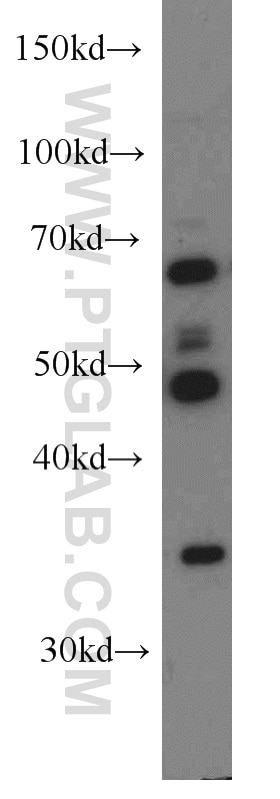 Western Blot (WB) analysis of A431 cells using HLA-F Polyclonal antibody (55379-1-AP)