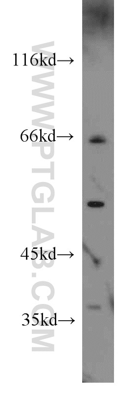 Western Blot (WB) analysis of Raji cells using HLA-F Polyclonal antibody (55379-1-AP)