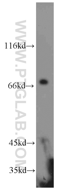 Western Blot (WB) analysis of human placenta tissue using HLA-F Polyclonal antibody (55379-1-AP)