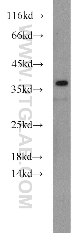 Western Blot (WB) analysis of mouse spleen tissue using HLA-F Polyclonal antibody (55379-1-AP)