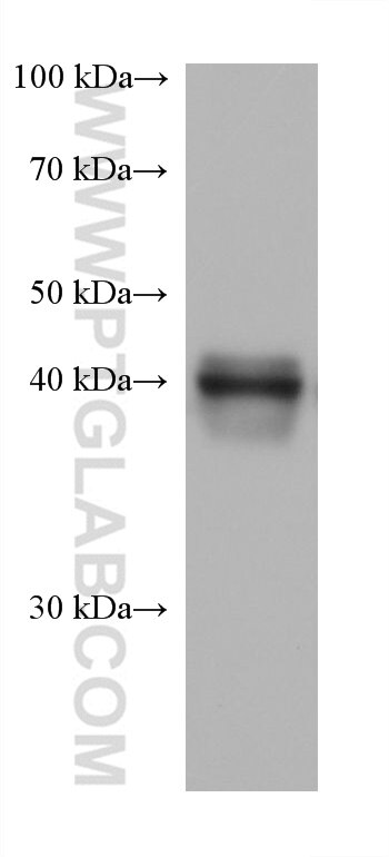 Western Blot (WB) analysis of NCCIT cells using HLA-F Monoclonal antibody (66819-1-Ig)