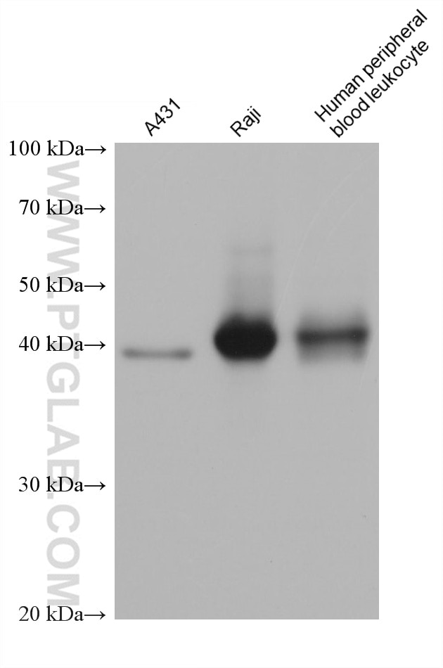 Western Blot (WB) analysis of various lysates using HLA-F Monoclonal antibody (66819-1-Ig)