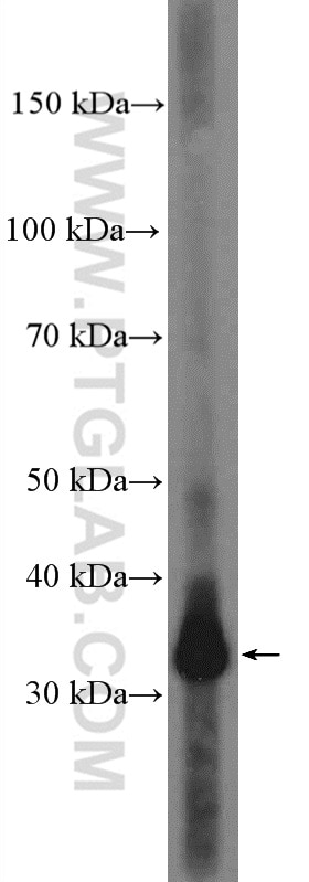 Western Blot (WB) analysis of human placenta tissue using HLA-G Polyclonal antibody (16913-1-AP)