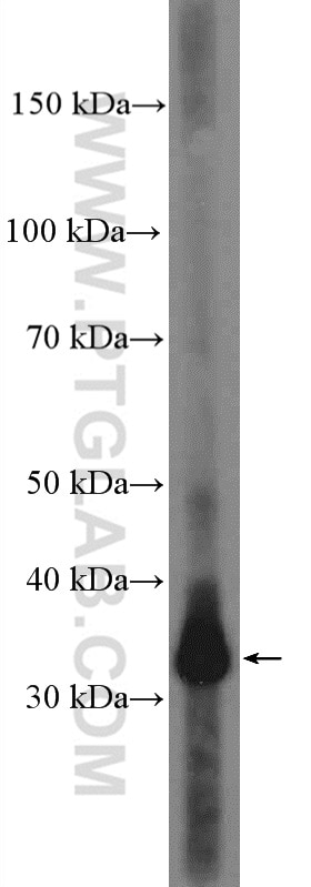 WB analysis of human placenta using 16913-1-AP