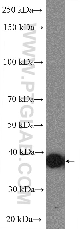 Western Blot (WB) analysis of human placenta tissue using HLA-G Polyclonal antibody (16913-1-AP)