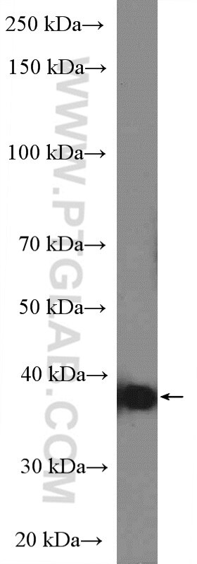 Western Blot (WB) analysis of human placenta tissue using HLA-G Polyclonal antibody (16913-1-AP)