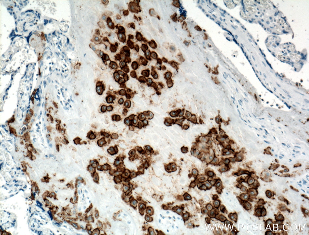 Immunohistochemistry (IHC) staining of human placenta tissue using HLA-G Monoclonal antibody (66447-1-Ig)