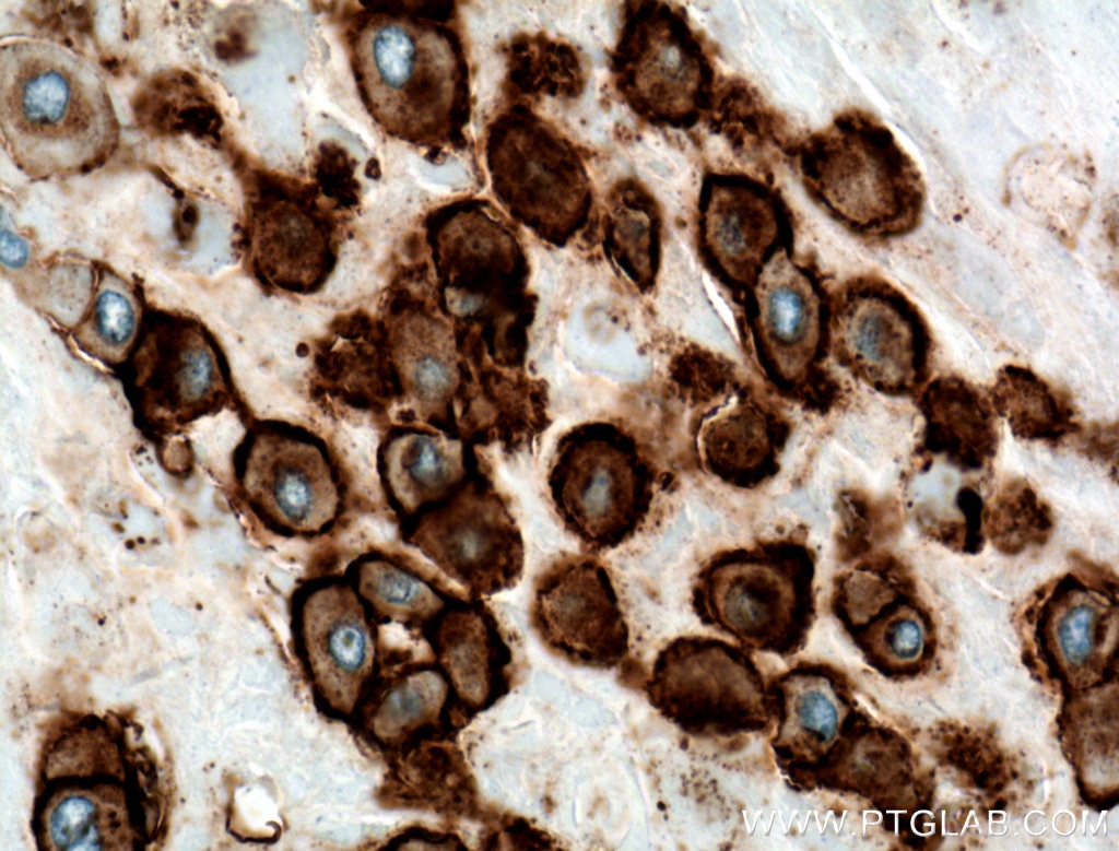 Immunohistochemistry (IHC) staining of human placenta tissue using HLA-G Monoclonal antibody (66447-1-Ig)