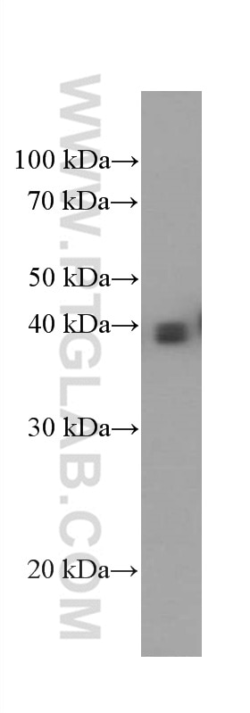 WB analysis of human placenta using 66447-1-Ig