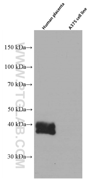 Western Blot (WB) analysis of human placenta tissue using HLA-G Monoclonal antibody (66447-1-Ig)