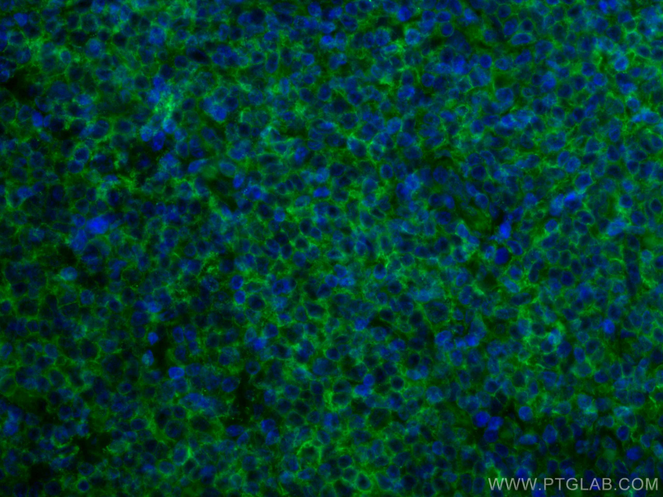 Immunofluorescence (IF) / fluorescent staining of human tonsillitis tissue using CoraLite® Plus 488-conjugated HLA class I ABC Mono (CL488-66013)