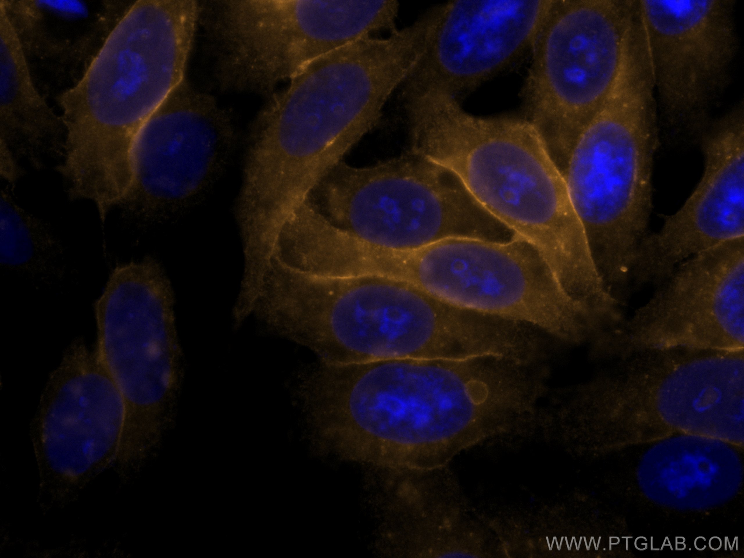 Immunofluorescence (IF) / fluorescent staining of HepG2 cells using CoraLite®555-conjugated HLA class I ABC Polyclonal (CL555-15240)