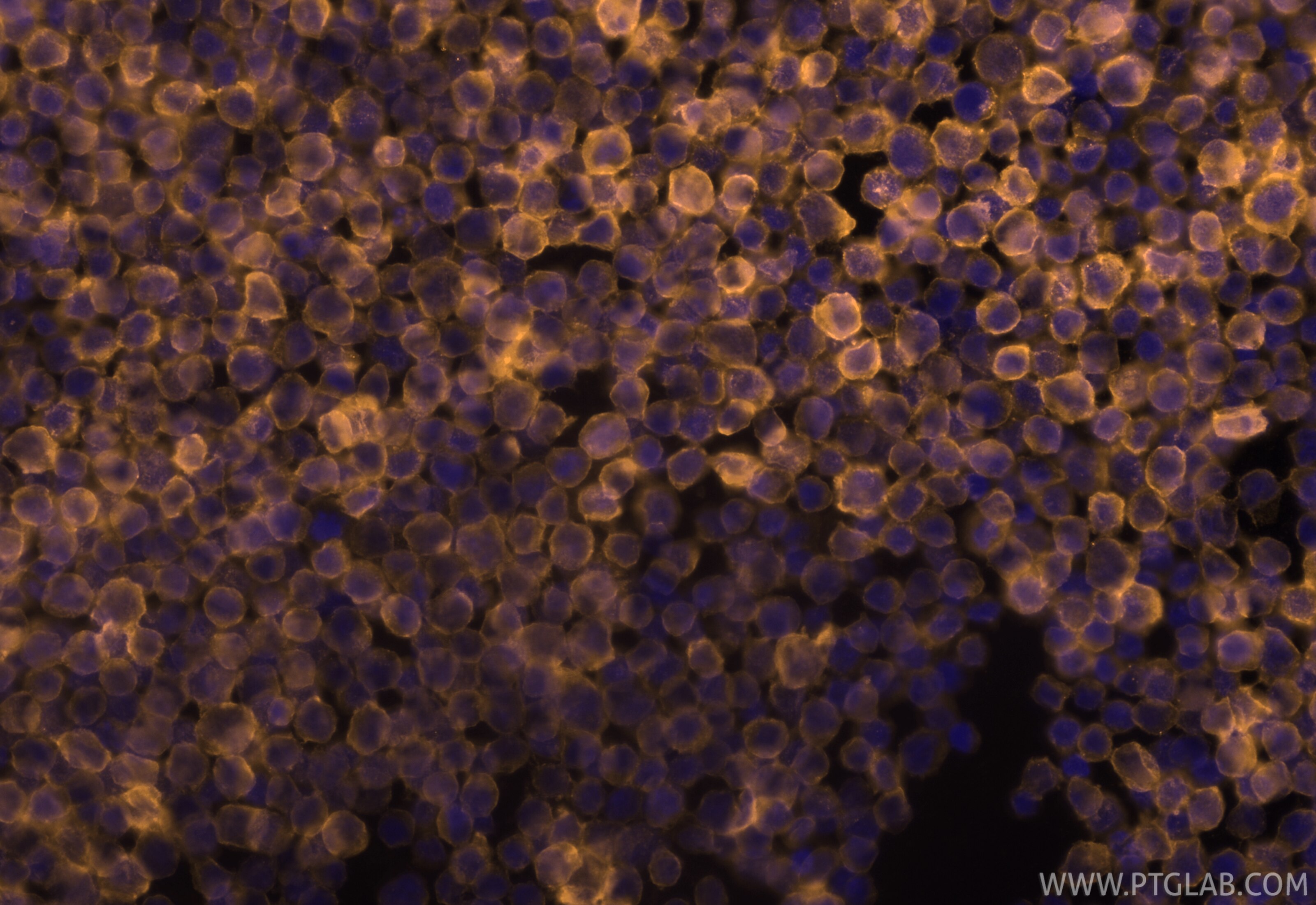 Immunofluorescence (IF) / fluorescent staining of Raji cells using CoraLite®555-conjugated HLA class I ABC Polyclonal (CL555-15240)