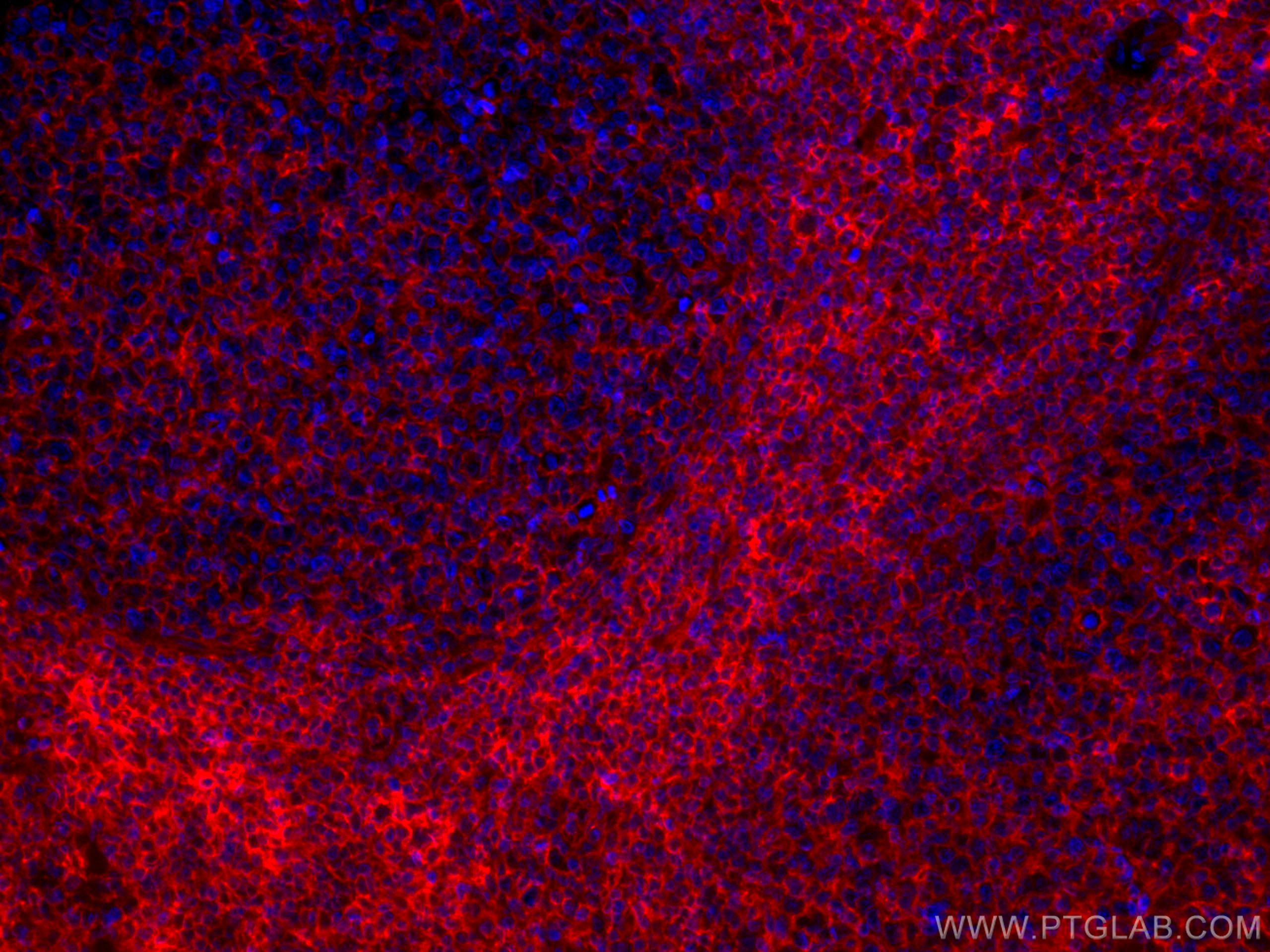 Immunofluorescence (IF) / fluorescent staining of human tonsillitis tissue using CoraLite®594-conjugated HLA class I ABC Monoclonal (CL594-66013)
