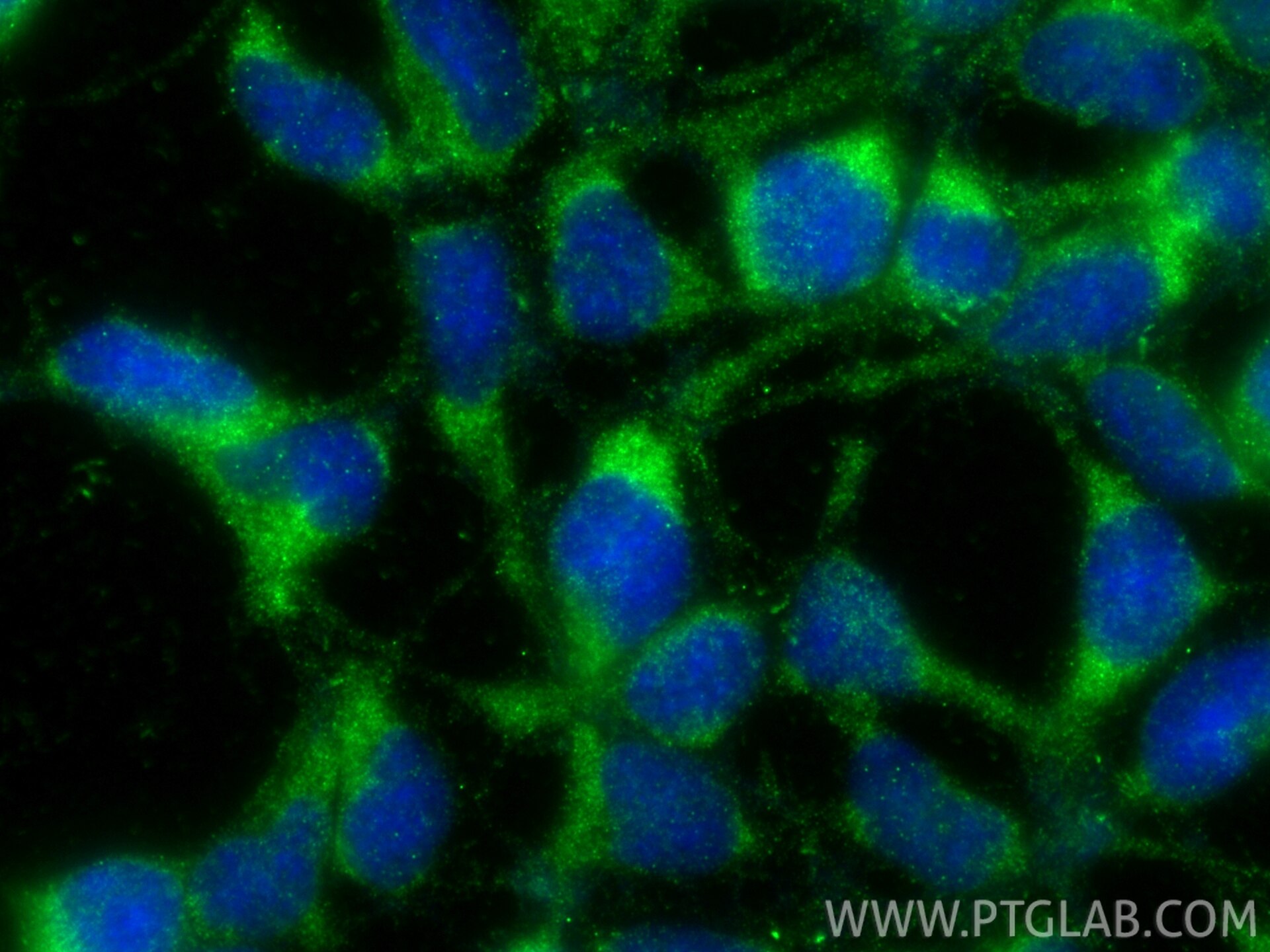 Immunofluorescence (IF) / fluorescent staining of HEK-293 cells using HLCS Polyclonal antibody (14046-1-AP)