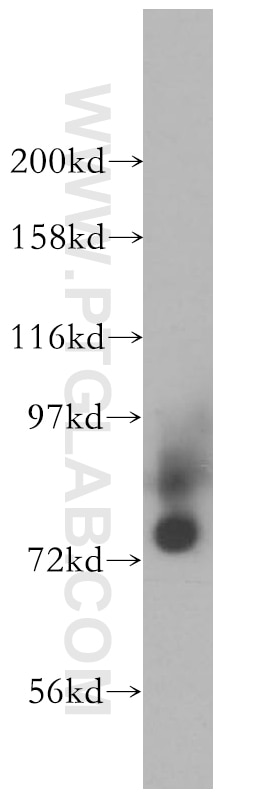 Western Blot (WB) analysis of human kidney tissue using HLCS Polyclonal antibody (14046-1-AP)