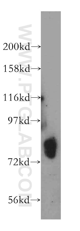 Western Blot (WB) analysis of human liver tissue using HLCS Polyclonal antibody (14046-1-AP)