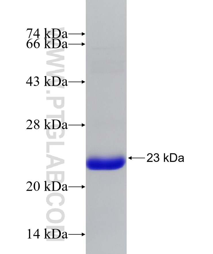 HLCS fusion protein Ag32480 SDS-PAGE HLCS fusion protein Ag32480 SDS-PAGE