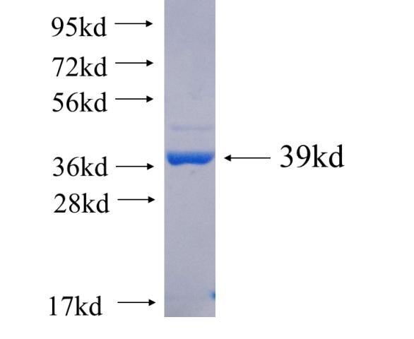 HLCS fusion protein Ag5926 SDS-PAGE