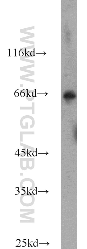 Western Blot (WB) analysis of HEK-293 cells using HLF Polyclonal antibody (12870-1-AP)