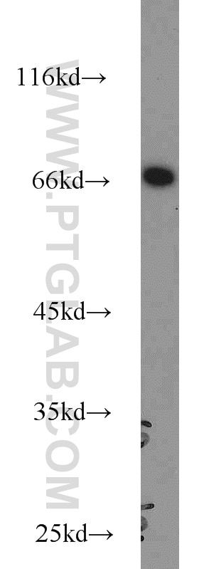 Western Blot (WB) analysis of HepG2 cells using HLF Polyclonal antibody (12870-1-AP)