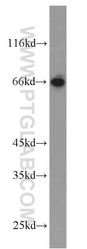 Western Blot (WB) analysis of mouse liver tissue using HLF Polyclonal antibody (12870-1-AP)