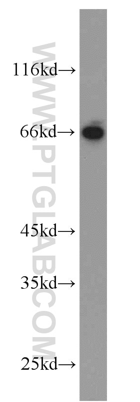 WB analysis of mouse liver using 12870-1-AP