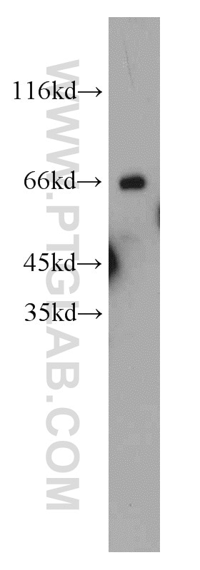 Western Blot (WB) analysis of mouse brain tissue using HLF Polyclonal antibody (12870-1-AP)
