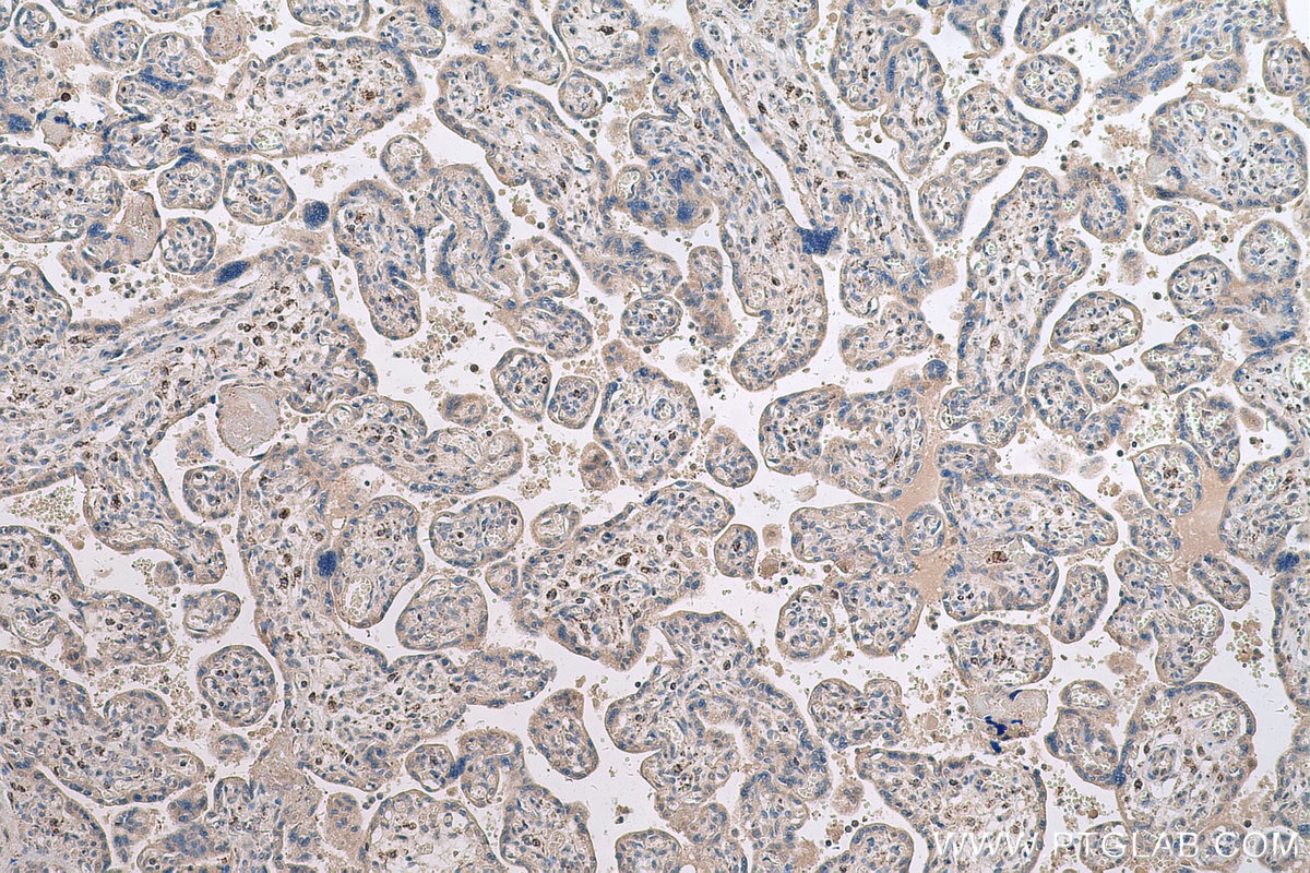 Immunohistochemistry (IHC) staining of human placenta tissue using HLTF Polyclonal antibody (14286-1-AP)