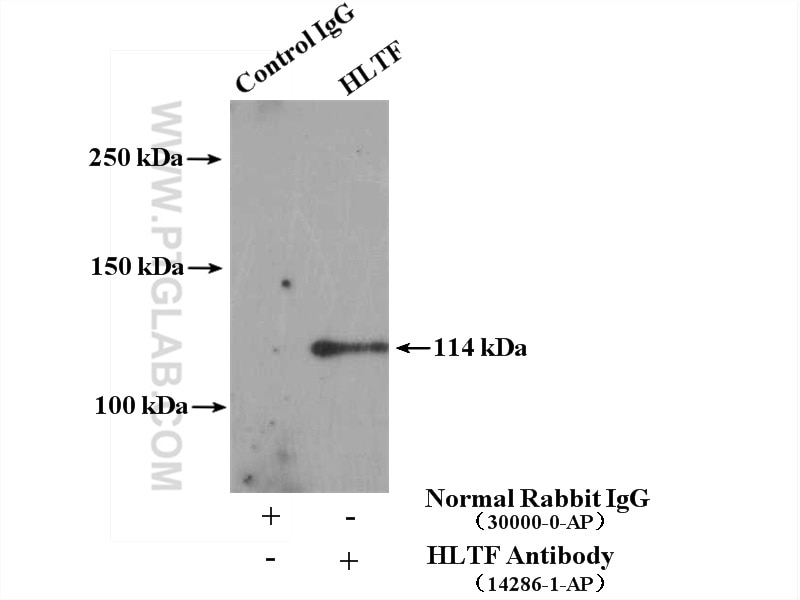 Immunoprecipitation (IP) experiment of HeLa cells using HLTF Polyclonal antibody (14286-1-AP)