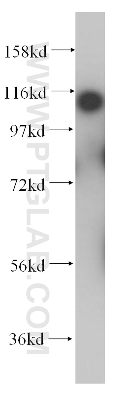 Western Blot (WB) analysis of HeLa cells using HLTF Polyclonal antibody (14286-1-AP)