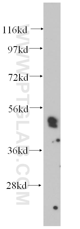 Western Blot (WB) analysis of human placenta tissue using HLX Polyclonal antibody (14336-1-AP)