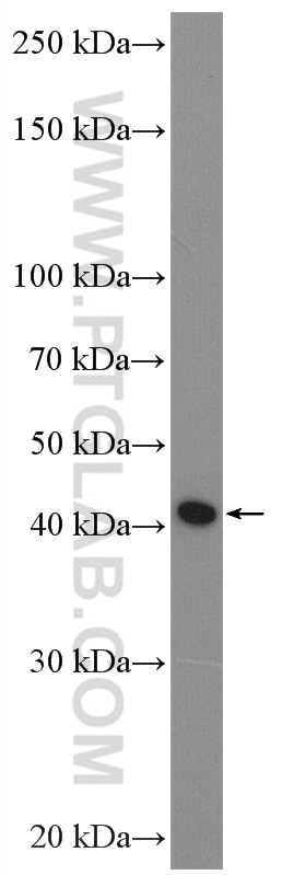 WB analysis of U2OS using 20416-1-AP