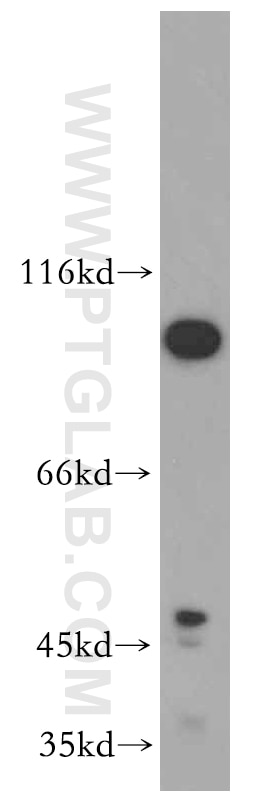 Western Blot (WB) analysis of HEK-293 cells using SPP Polyclonal antibody (20416-1-AP)
