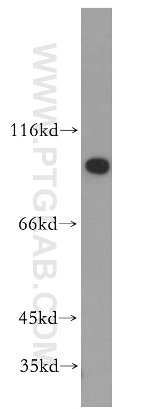 Western Blot (WB) analysis of mouse kidney tissue using SPP Polyclonal antibody (20416-1-AP)