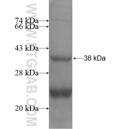 SPP fusion protein Ag14158 SDS-PAGE