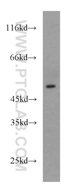 Western Blot (WB) analysis of mouse brain tissue using HMBOX1 Polyclonal antibody (16123-1-AP)