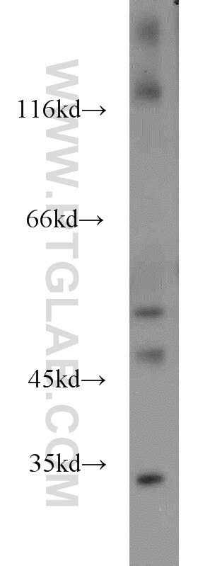 Western Blot (WB) analysis of mouse brain tissue using HMBOX1 Polyclonal antibody (16123-1-AP)