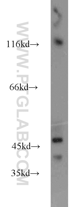 Western Blot (WB) analysis of mouse brain tissue using HMBOX1 Polyclonal antibody (16123-1-AP)