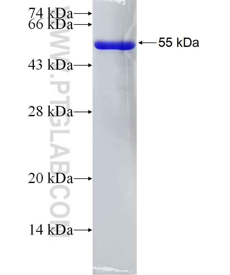 HMBOX1 fusion protein Ag9394 SDS-PAGE