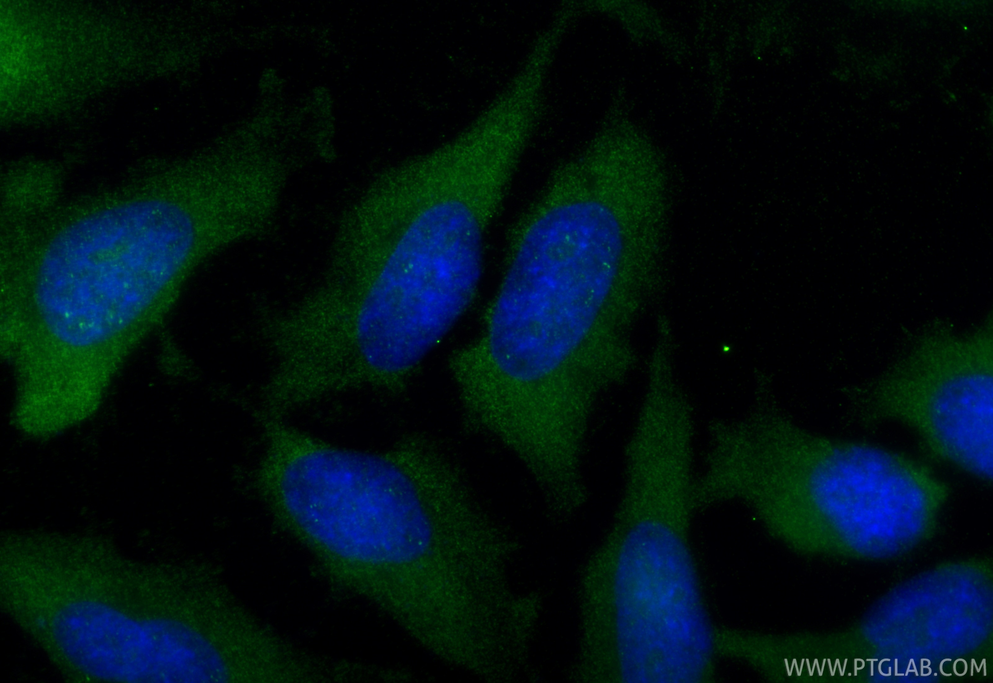Immunofluorescence (IF) / fluorescent staining of HeLa cells using HMBS Polyclonal antibody (14797-1-AP)